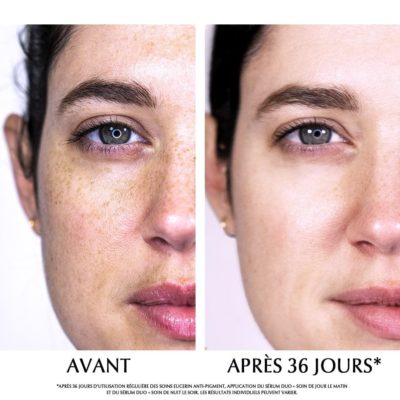 Avant apres anne laure anti pigment