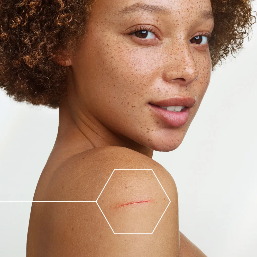 A-derma epitheliale a. H ultra repair crème réparatrice anti-marques 40ml