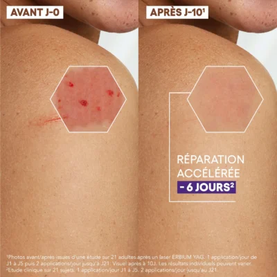 A-derma epitheliale a. H ultra repair crème réparatrice anti-marques 40ml