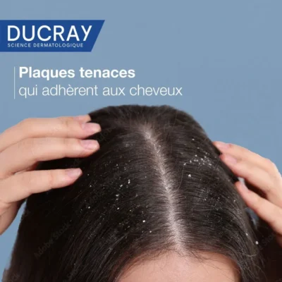 Ducray kelual squanorm shampoing traitant régulateur pellicules grasses 200ml