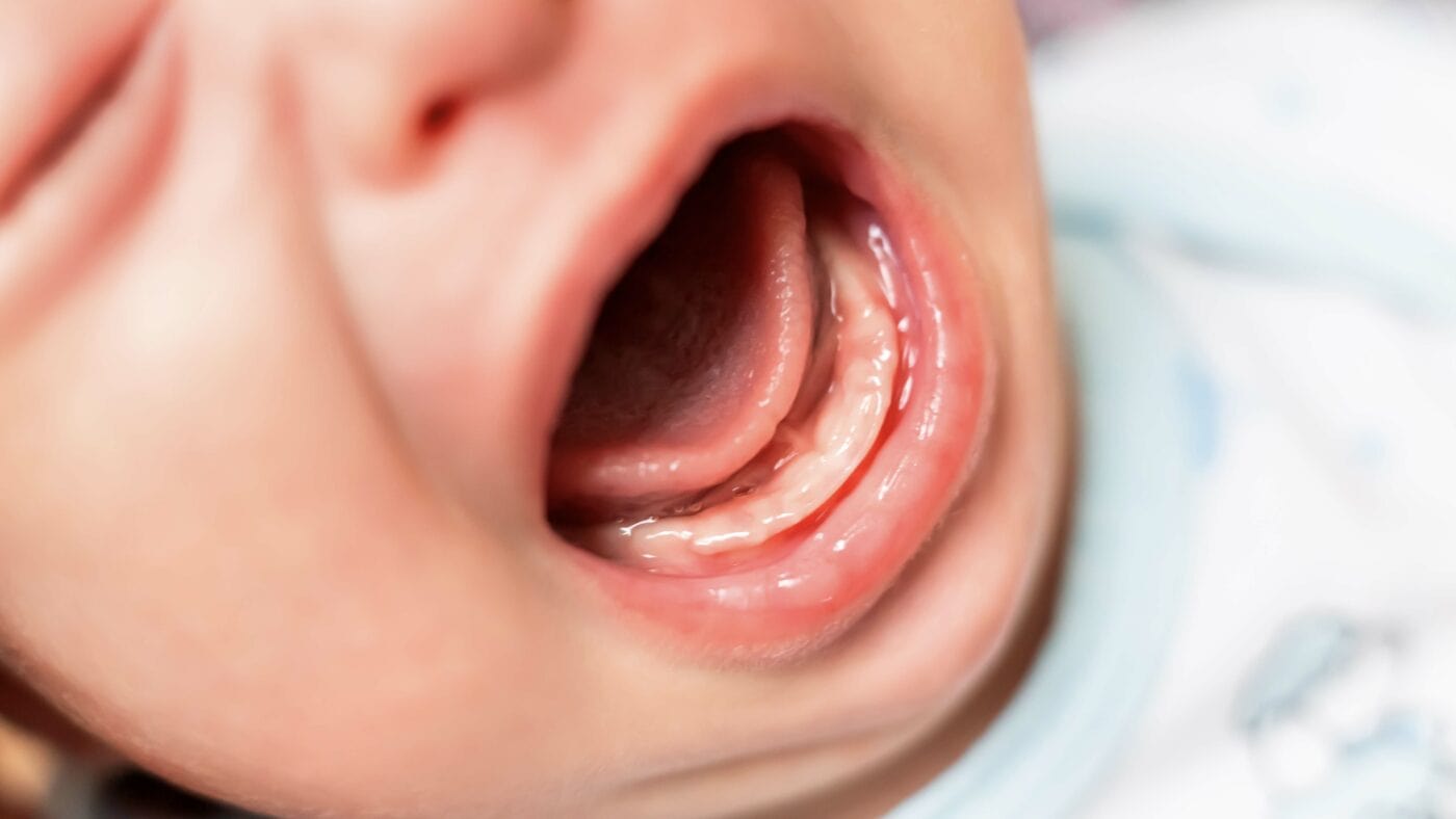 Bébé fait ses dents