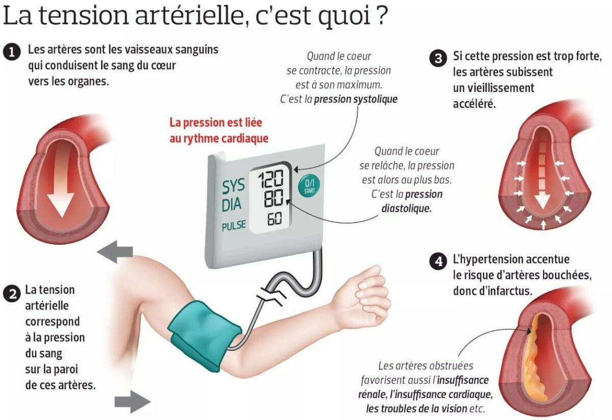 Hypertension artérielle