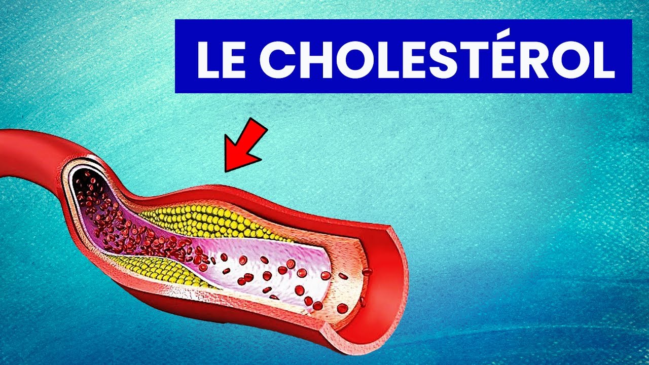 Cholestérol MaPara Tunisie — free download
