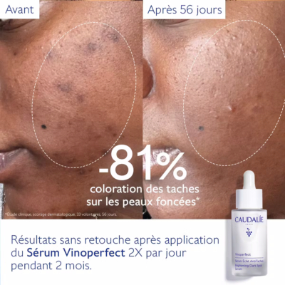 Caudalie vinoperfect sérum éclat anti-taches 30ml