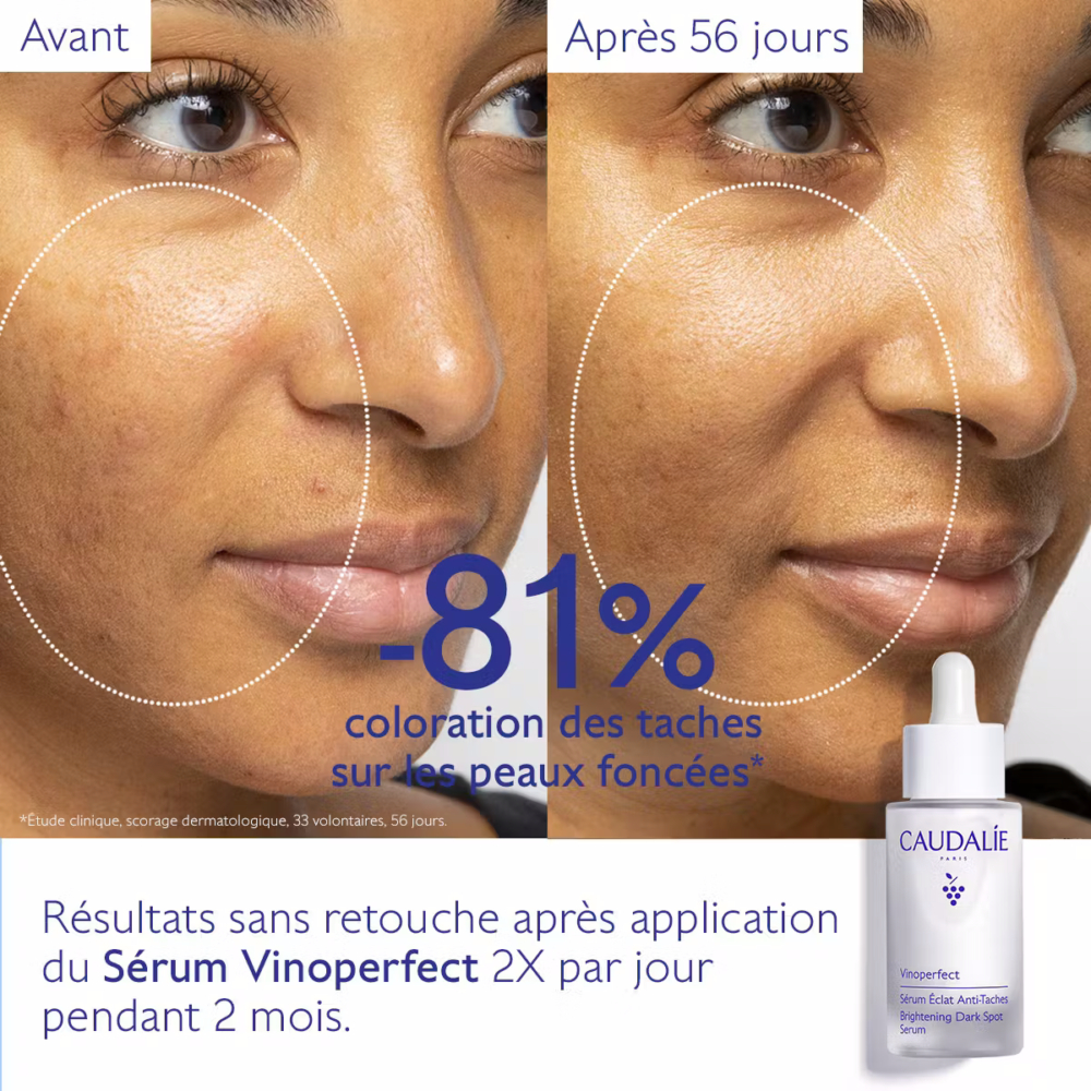 Caudalie vinoperfect sérum éclat anti-taches 30ml