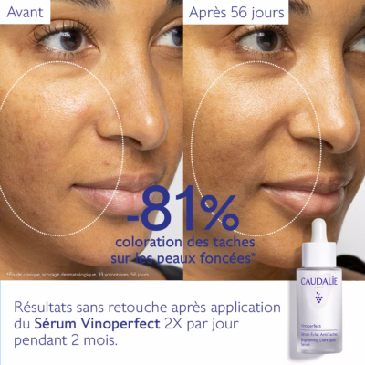 Caudalie vinoperfect sérum éclat anti-taches 30ml