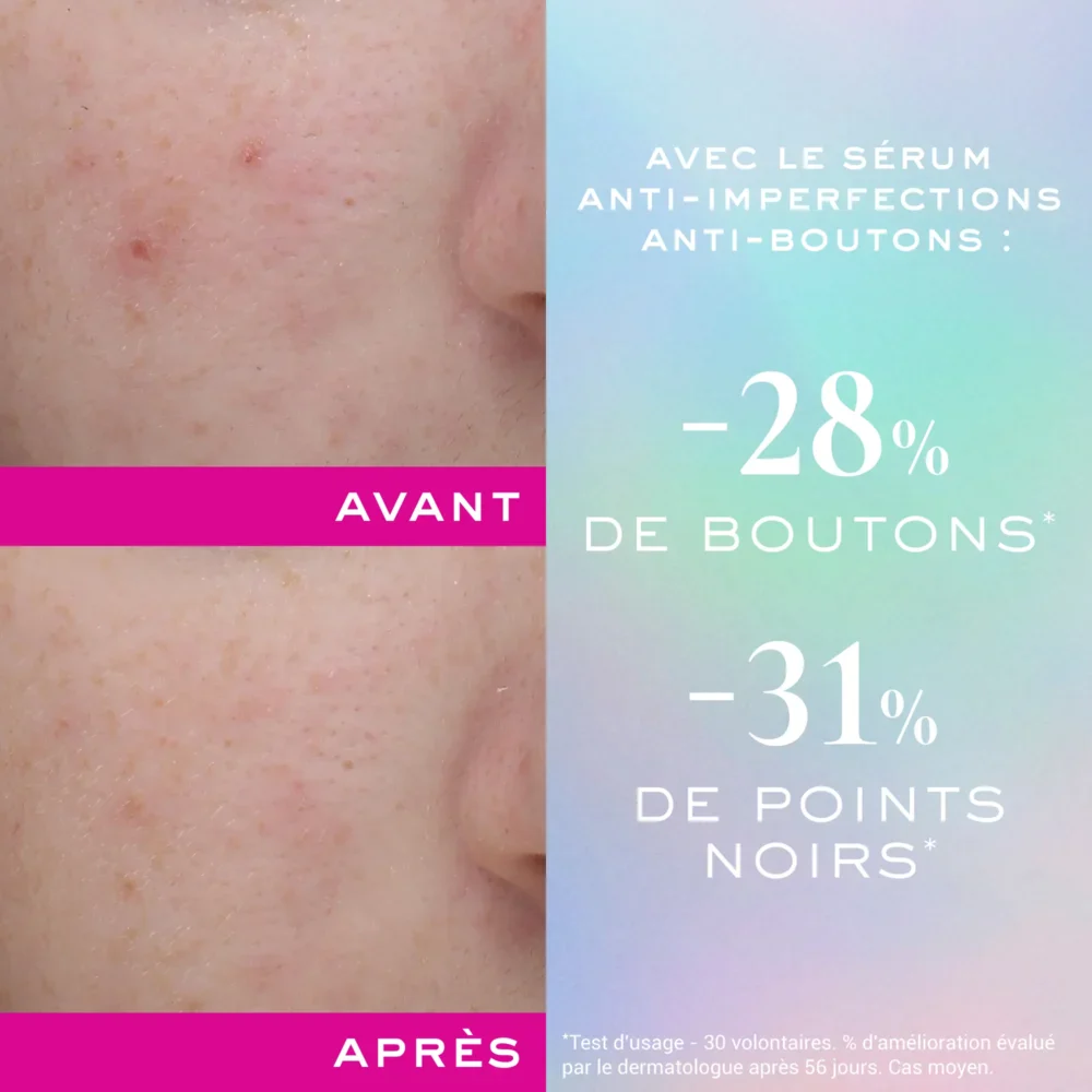 Nuxe zinc power sérum anti-imperfections anti-boutons 30ml