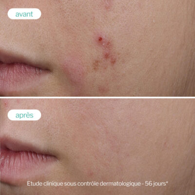 Novexpert trio zinc serum booster 30ml Novexpert trio zinc serum booster 30ml