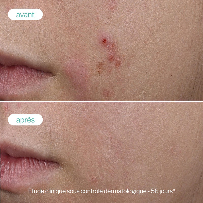 Novexpert trio zinc serum booster 30ml Novexpert trio zinc serum booster 30ml