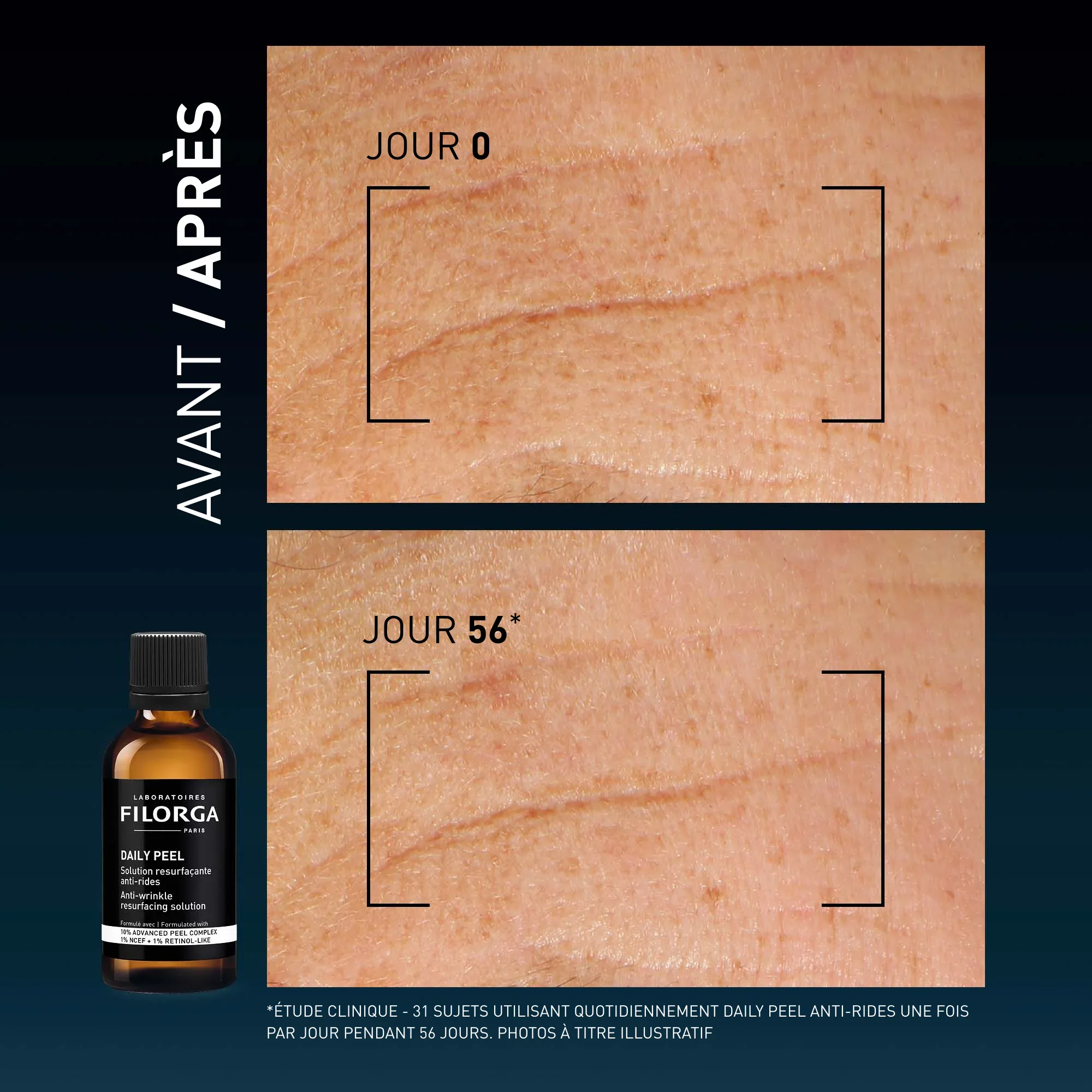Filorga daily peel solution resurfaçante anti-rides 50ml Filorga daily peel solution resurfaçante anti-rides 50ml