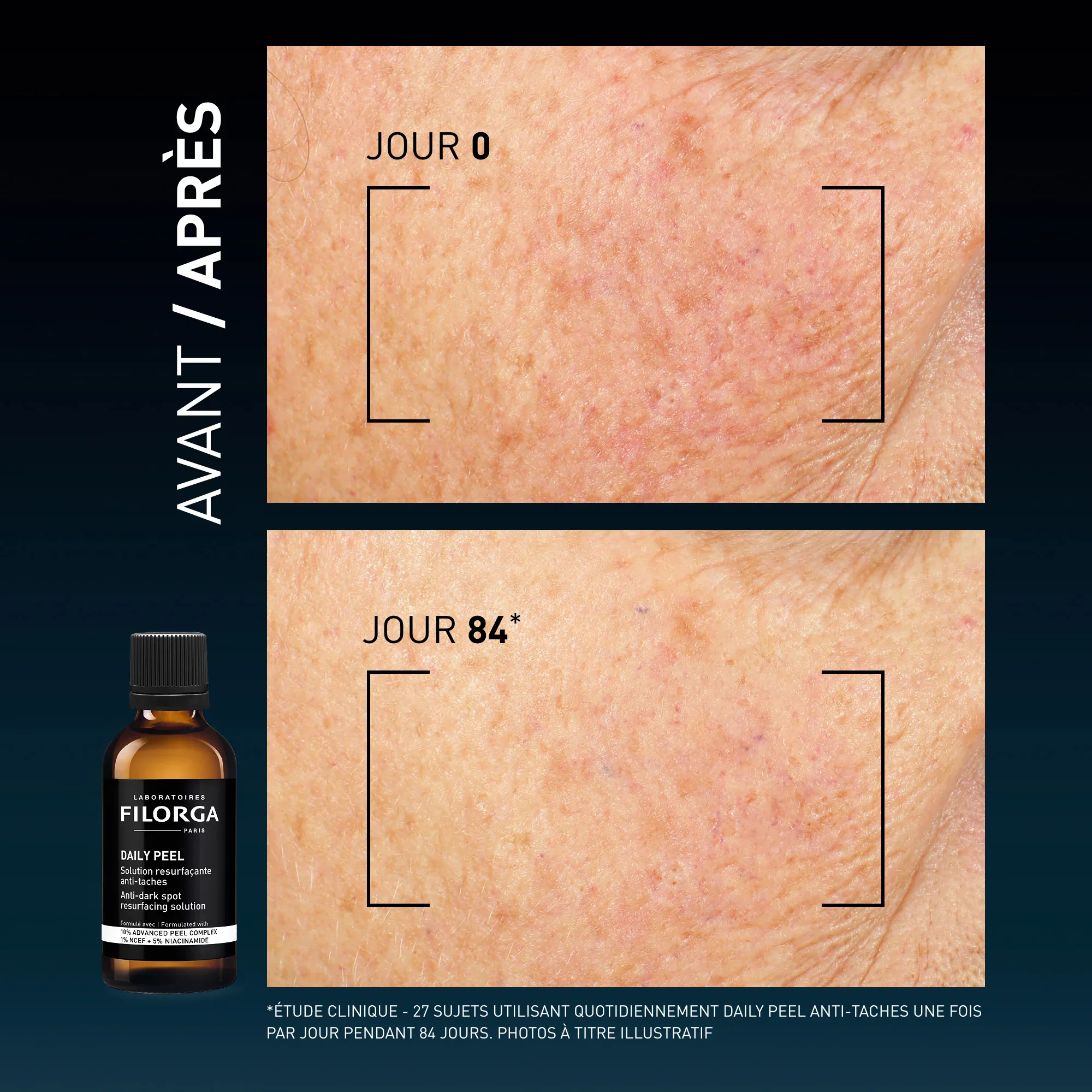 Filorga daily peel solution resurfaçante anti-taches 50ml Filorga daily peel solution resurfaçante anti-taches 50ml